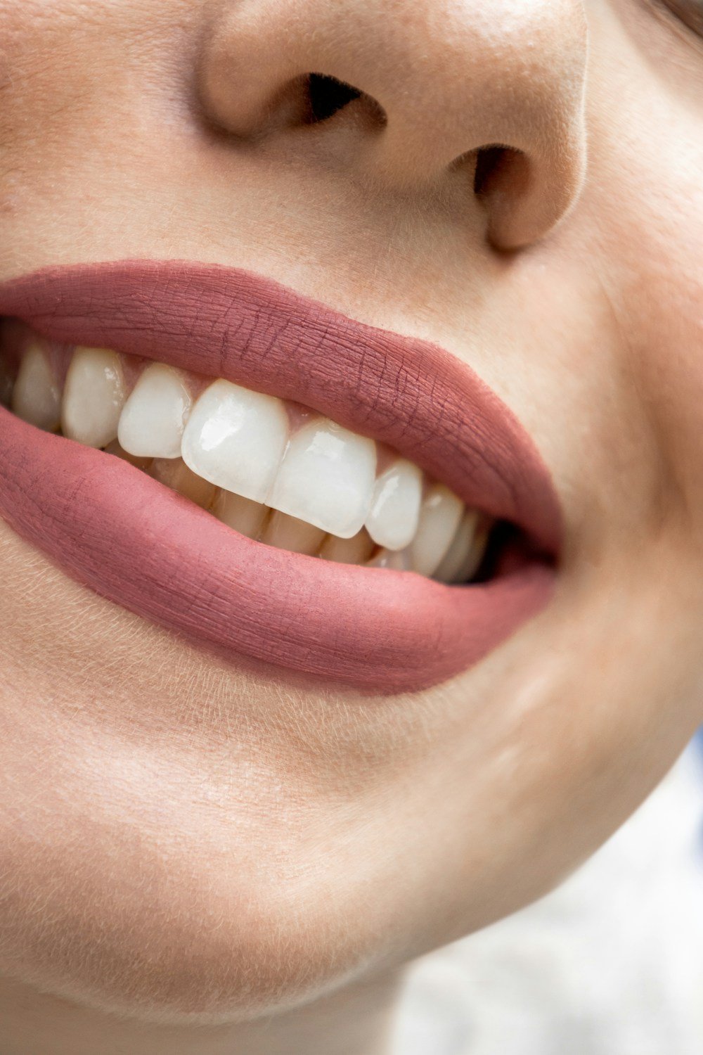 Close-up of a confident, healthy smile