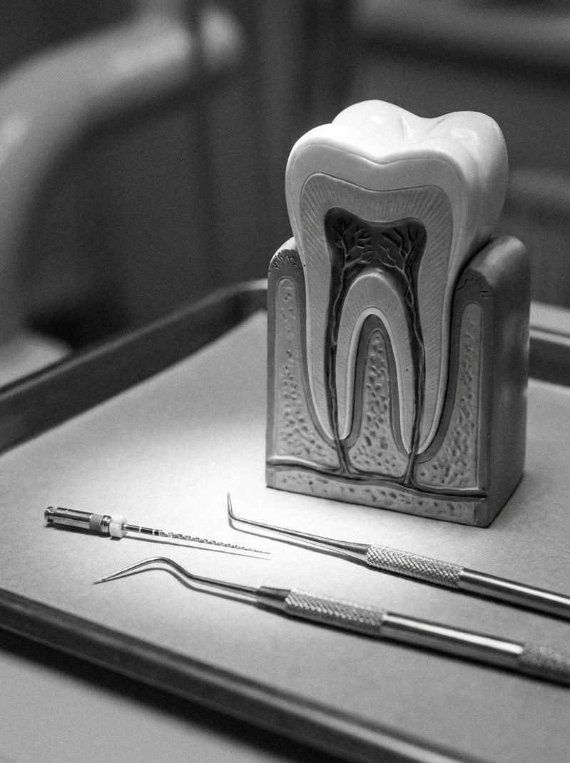 Root canal treatment at Acmē Dental