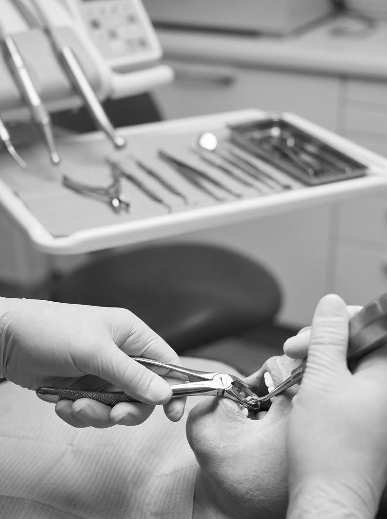 Tooth extraction procedure